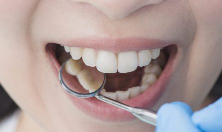 zbliżenie-na-biały-uśmiech-kobiety-u-dentysty