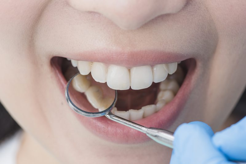 zbliżenie-na-biały-uśmiech-kobiety-u-dentysty