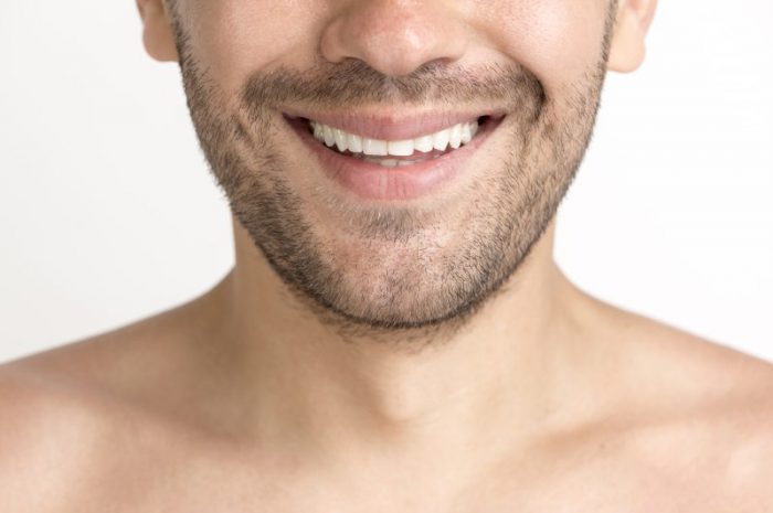 Wybielanie zębów – na czym polega i czego użyć?